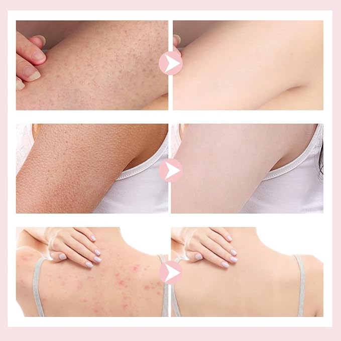 Super Soft Sunflower Suction Cup Bath Ball, 2025 New Bath Cleaning Brush, 2-in-1 Sponge Mesh Pouf Ball Body Scrubber, Shower Gloves Exfoliating Accessories for Men and Women (Apricot+Green)