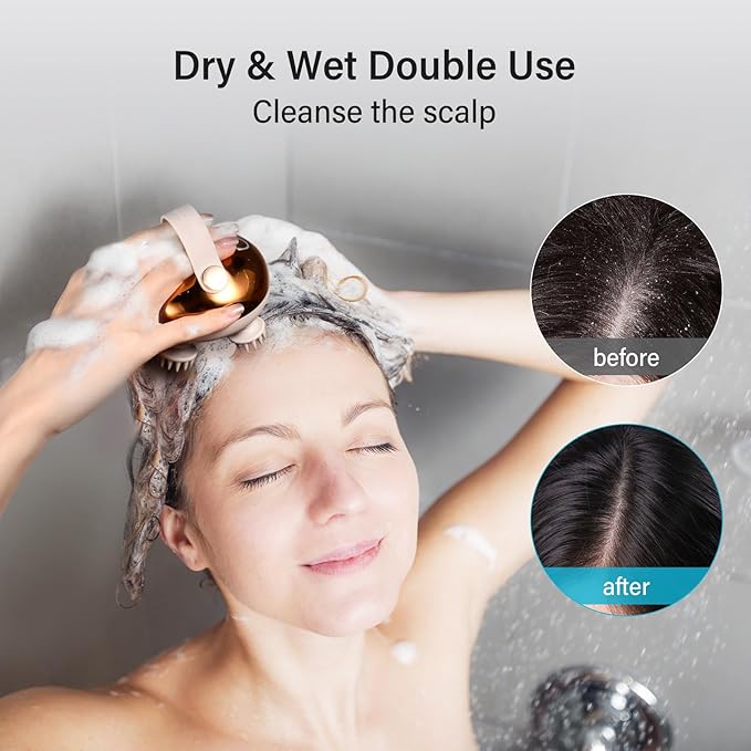 arboleaf Electric Scalp Massager Head Massager Scalp Stress Relax, 5 in 1 Kneading 128 Massage Nodes, Waterproof Hair Massage with 8 Removable Claws Cat Scratcher, Gift for Dad Mom