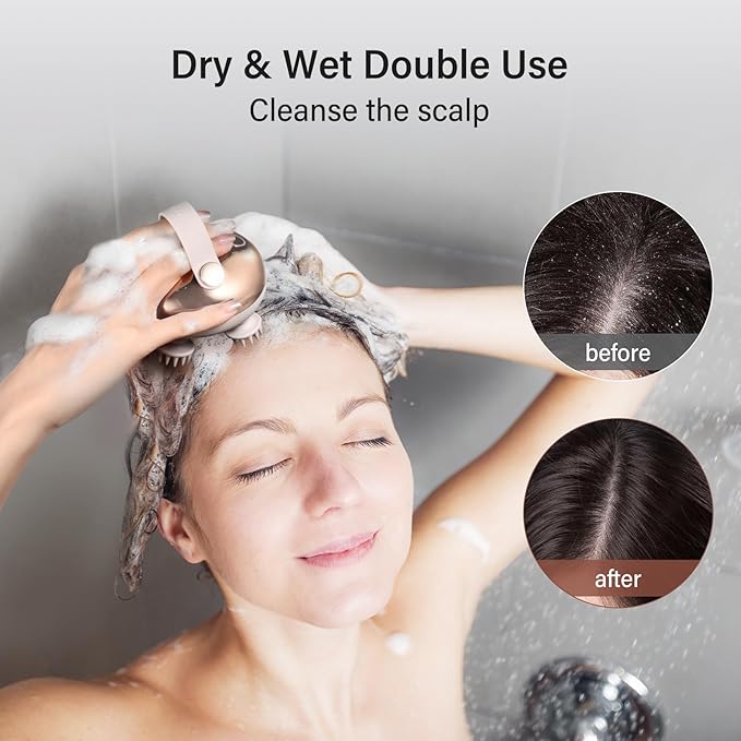 arboleaf Scalp Massager Kneading Head Massager Scalp Stress Relax Portable Rechargeable Hair Massager Shower Massage Waterproof Cat Massager Scratcher,Gift for Mom Dad