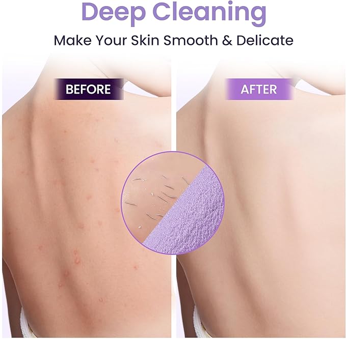 3 Pcs Double-Sided Back Exfoliator Body Scrub Towel, Exfoliating Back Scrubber with Handles,Exfoliating Washcloth Bath Tool in Shower, Stretchable Back Washer to Deep Cleans Skin (Beige,Pink,Purple)