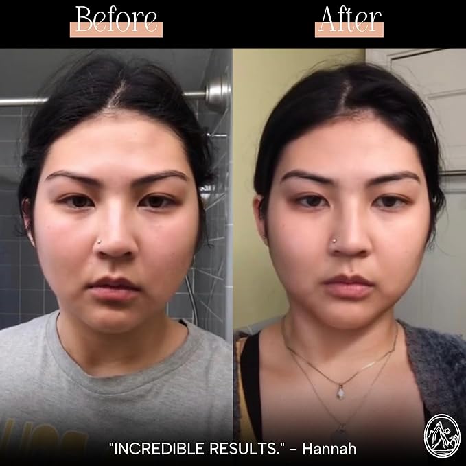 Mount Lai Stainless Steel Gua Sha Facial Tool – The Element of Refinement – Professional Grade Steel Face Sculpting Tool for Lymphatic Drainage, Puffiness Reduction & Refined Results