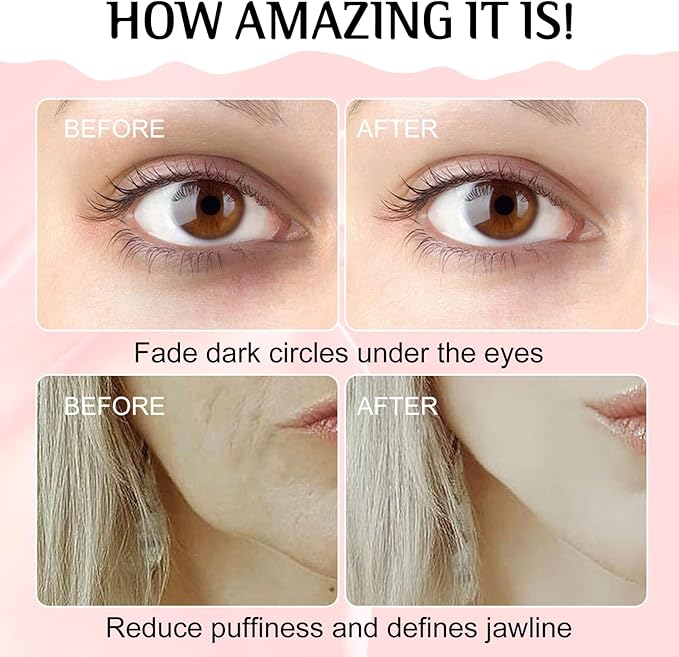 Gua Sha Facial Tools and Face Roller Set, Lymphatic Drainage Massager，Stainless Steel Facial Sculpting Eyes Roller Guasha for Face, Chin & Jawline Sculpting,Skin Care (White)