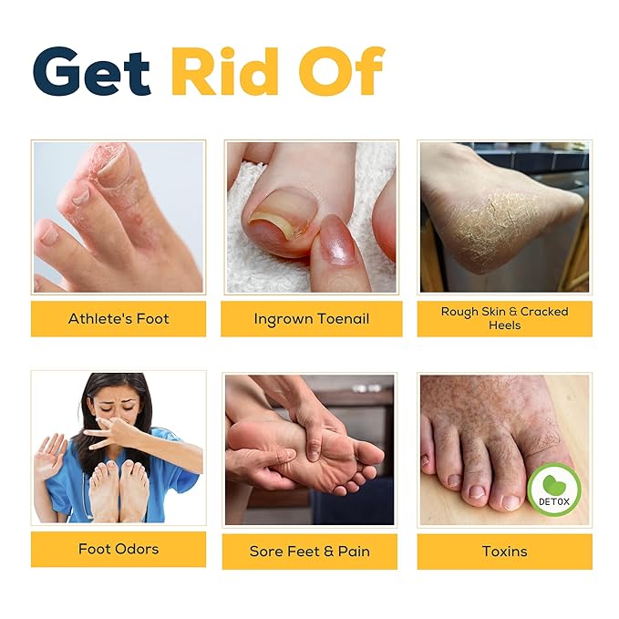 FOOT CURE Citrus Detox Foot Soak with Epsom Salts – for Foot Callus, Damaged Toenail Appearance, Pedicure Spa, and Soothing Sore, Tired Feet - 16 oz (Pack of 1)